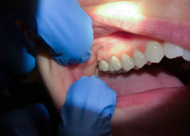 Best Emergency Dental Surgery in Wood River, NE